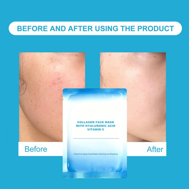 Collagen Hyaluronic Acid Vitamin C Peptide Aloe Vera Face Mask Instant Brightening Moisturizing Anti-Aging