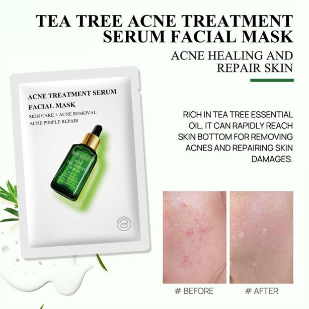 Acne Treatment Serum Facial Mask Whitening Moisturizing Cream