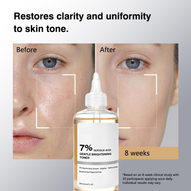 Glycolic Acid 7% Exfoliating Toner Brightening Skin Smoothing Daily Toner