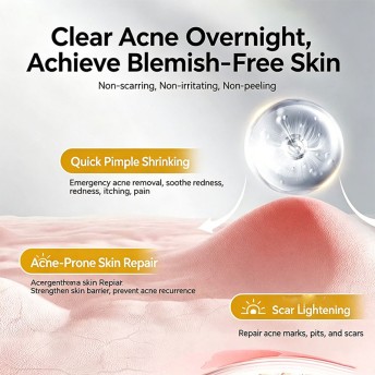 Anti Acne Facial Cream with Perilla Ocymoides Extract, Oil Control, Pore Minimizing, Firming and Anti-Wrinkle